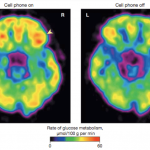 Cell Phones And The Brain: Can We Tell Whether Cell Phones Are Harmful? -  Science in the News